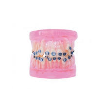 TM-B5-02 Ortho Model with Meral & Ceramic Bracket